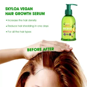 DeeVoo™ Scalp Treatment HairGrᴏᴡth Serum