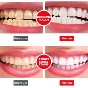 Fivfivgo™ 4TM Probiotic Whitening Toothpaste