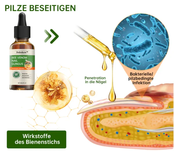 Dobshow™ Bienengift Nagelpilz-Behandlung Liquid