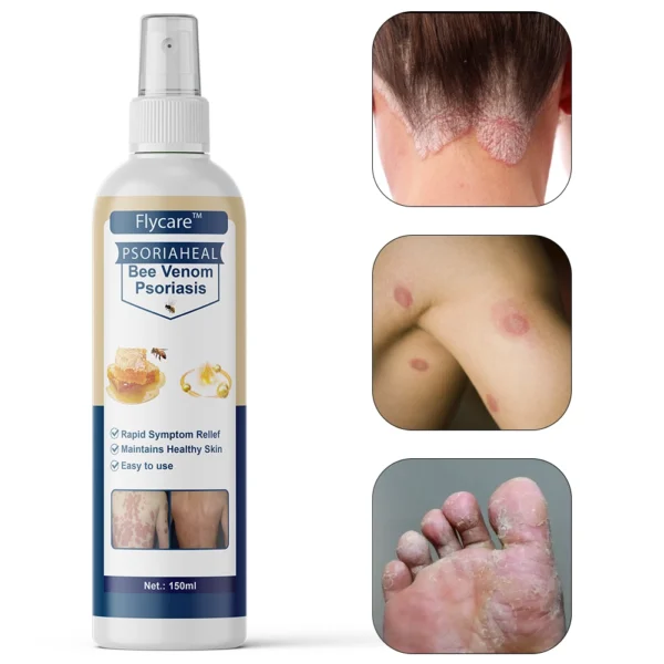 Professional remedy for psoriasis on the body