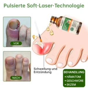 Dobshow™ Bienengift Nagelpilz-Behandlung Liquid