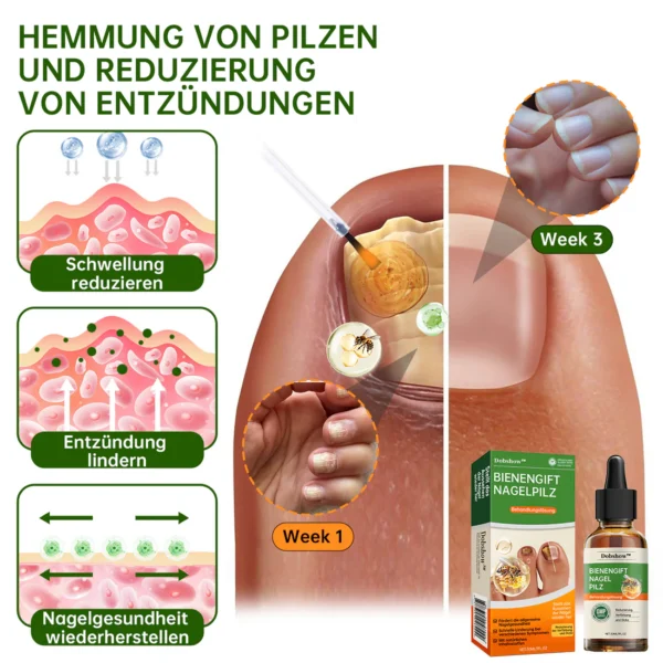 Dobshow™ Bienengift Nagelpilz-Behandlung Liquid