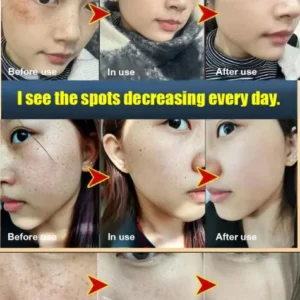 Whitening and Spot-Removing Cream