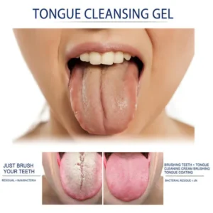 Probiotic Tongue Cleaning Gel Set