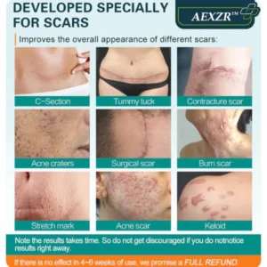 AEXZR™ Advanced Scar Spray