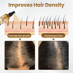 CVREOZ™ Biotin Hair Growth Premium Serum – Proven and Tested by Experts!